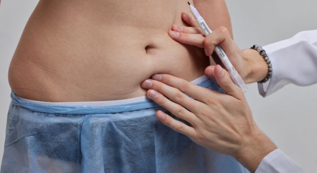 Smart Lipo for First-Timers: A Practical Guide to Price, Discomfort, and Recovery